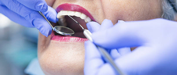 Best Emergency Tooth Extraction in Pioneer, CA